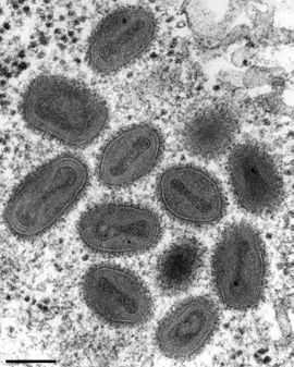 Smallpox virus under the electron microscope.