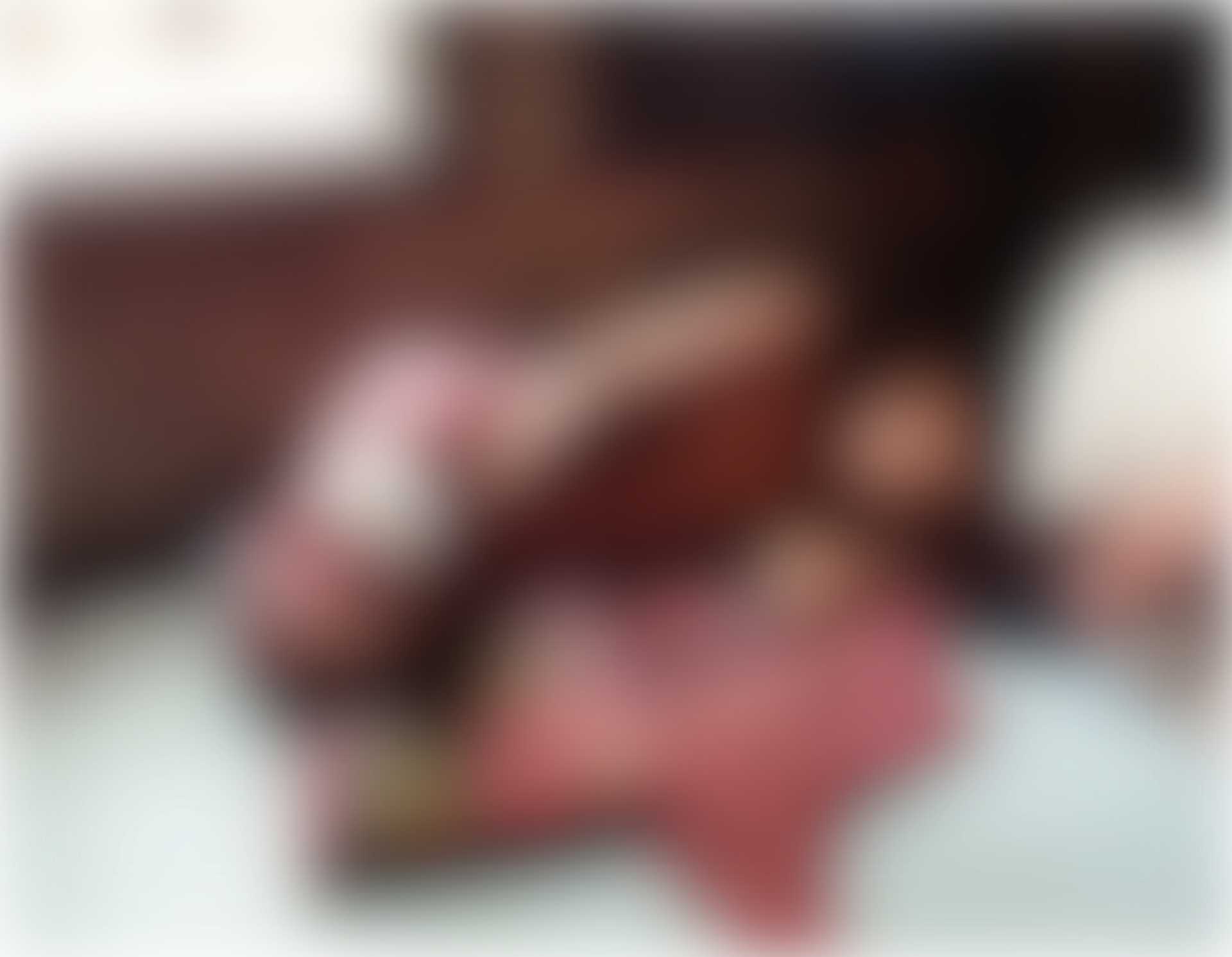 Pixelated photograph showing a young person lying on a bed inside a modest room, with a bandaged leg that has been amputated below the knee.